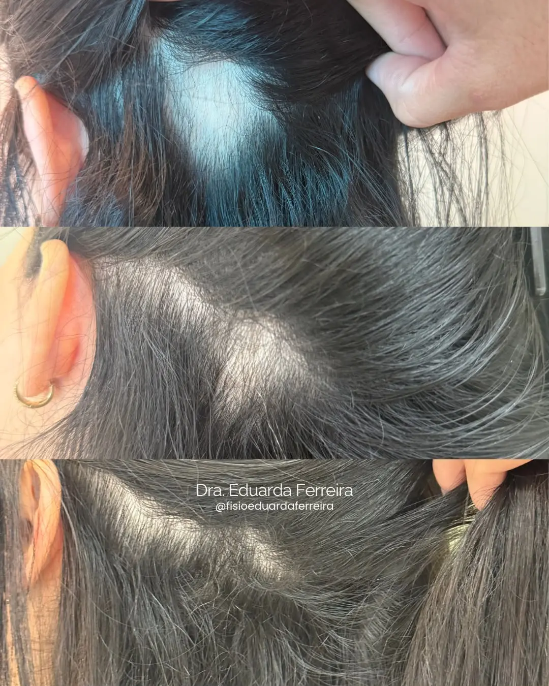 Resultado do tratamento capilar - Antes e Depois 2